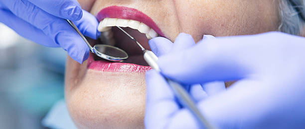Best Broken Tooth Emergency  in Ste Genevieve, MO